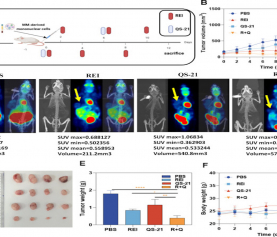 Zhaoyun, L., et al. Enhancing antitumor immunity via ROS-ERS and pyroptosis-induced immunogenic cell death in multiple myeloma.